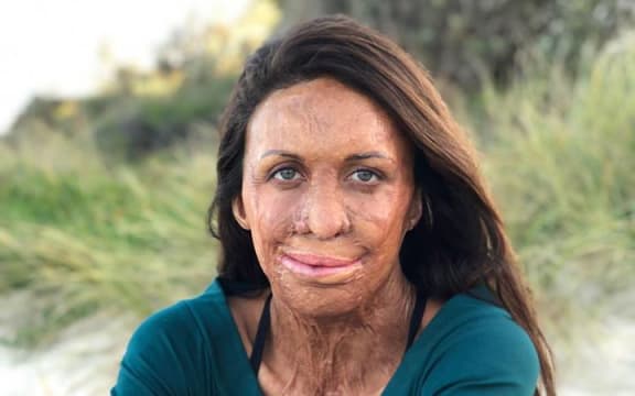 Turia Pitt