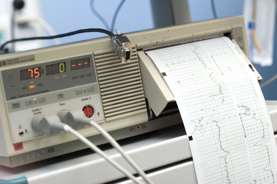 Foetal heartbeat monitor