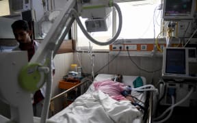 An Indian patient being cared for with a ventilator to help with breathing.