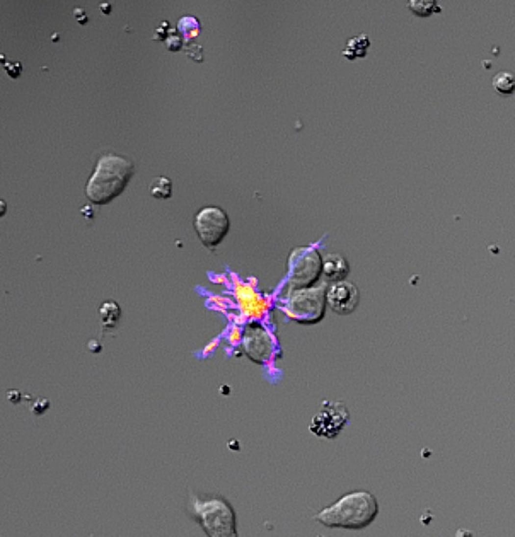 A microscopy photo which shows a Dendritic Cell educating T-Cells to form a large population to fight a disease.