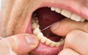 The New Zealand Dental Association will review its flossing guidelines after the US government dropped the practice from its dietary recommendations.