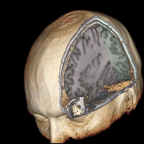 A 3D model of the brain