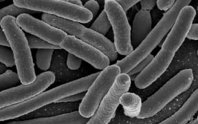 Escherichia coli, one of the many species of bacteria present in the human gut