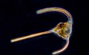 Algae similar to this magnified dinoflagellate could be the source of a powerful local anesthetic.