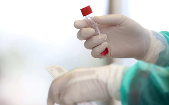 Medical staff member with mask and protective equipment holds Coronavirus nasal swabs test tubes at drive-through testing point in an effort to curb the spread of COVID-19 (novel coronavirus)