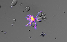 A microscopy photo which shows a Dendritic Cell educating T-Cells to form a large population to fight a disease.