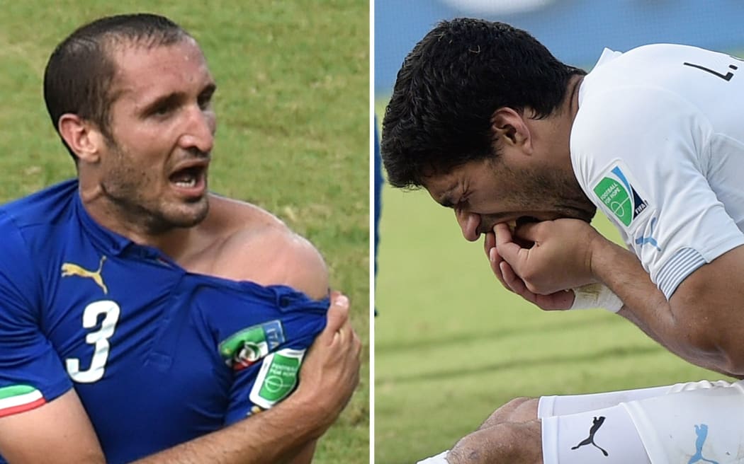Giorgio Chiellini (left) showing an apparent bite mark and Luis Suarez after the Group D football match on Tuesday.