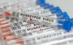 Illustration of test tubes labs labelled Monkeypox virus test.