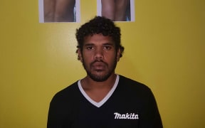 Another victim of the alleged police brutality.