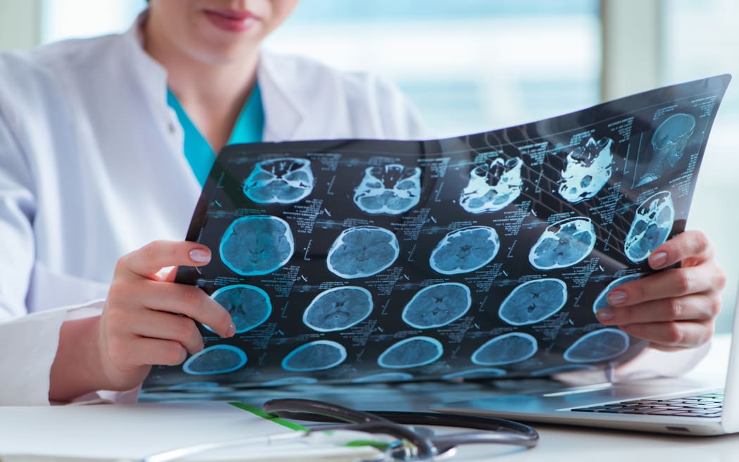 The doctor examining MRI image in hospital.