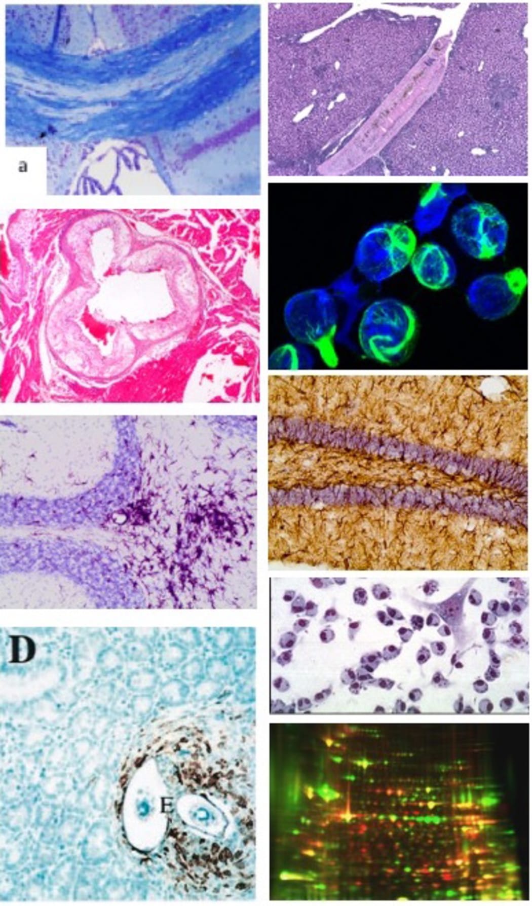 Auto immunity image collage