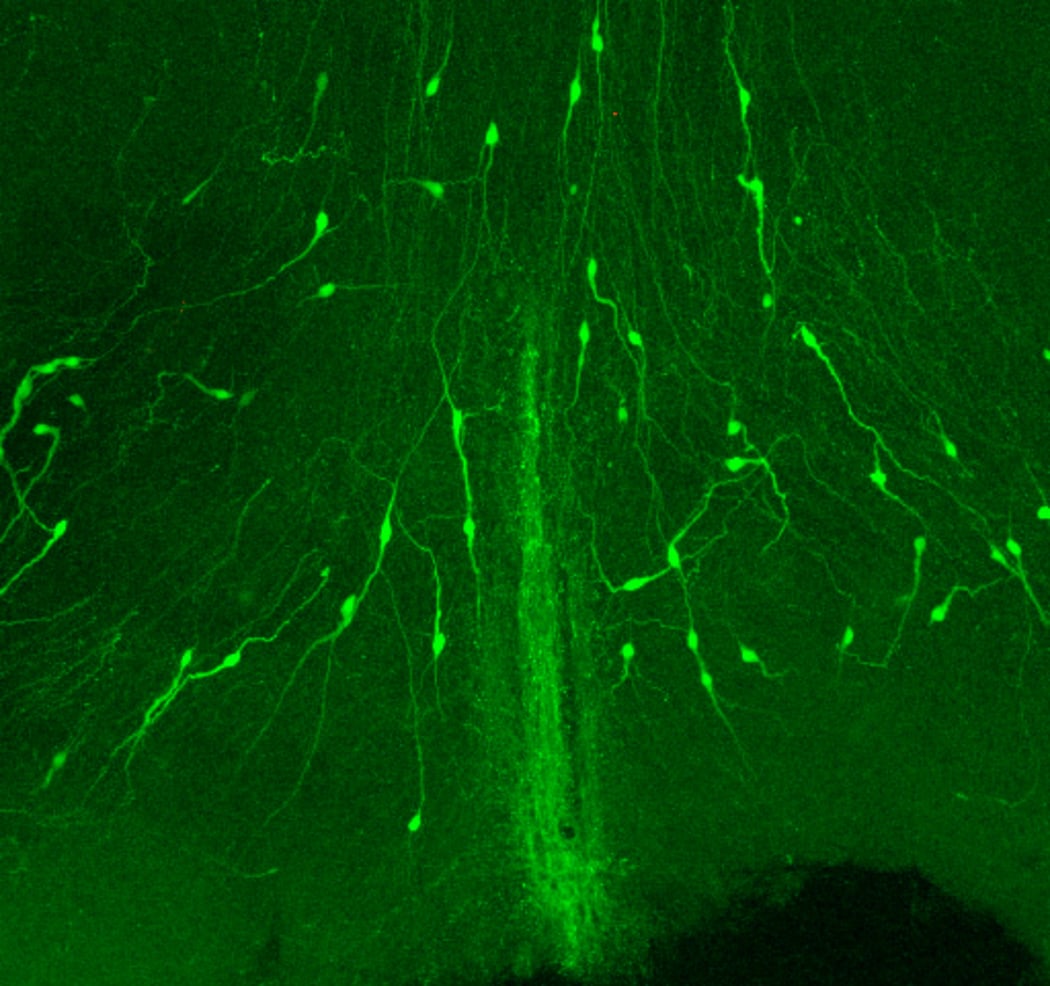 GnRH neurons in the brain