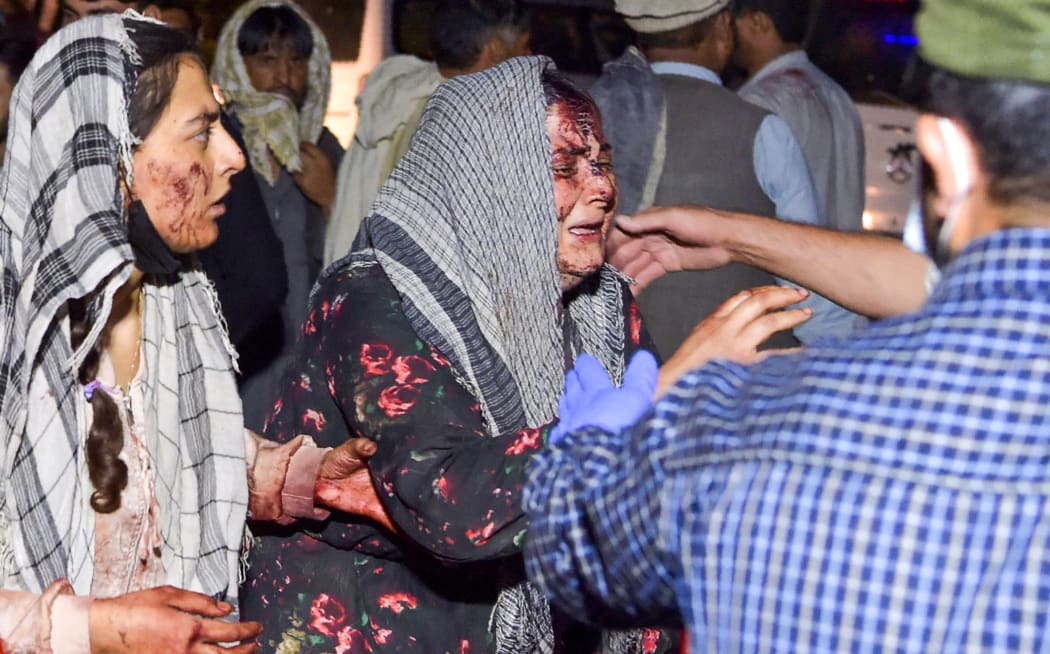 EDITORS NOTE: Graphic content / Wounded women arrive at a hospital for treatment after two blasts, which killed at least five and wounded a dozen, outside the airport in Kabul on August 26, 2021. (Photo by Wakil KOHSAR / AFP)