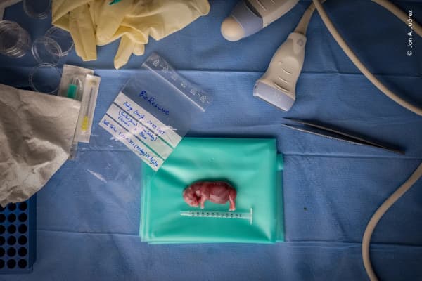 How to Save a Species by Jon A Juárez, Spain. The documented process of saving a northern white rhino from extinction through in vitro fertilisation.