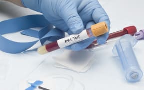 A test tube for a prostate cancer antigen next to a catheter and a blue ribbon (file photo)