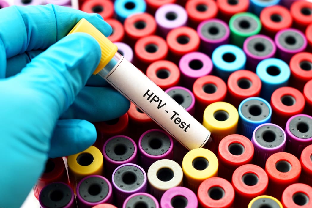 HPV test tube.