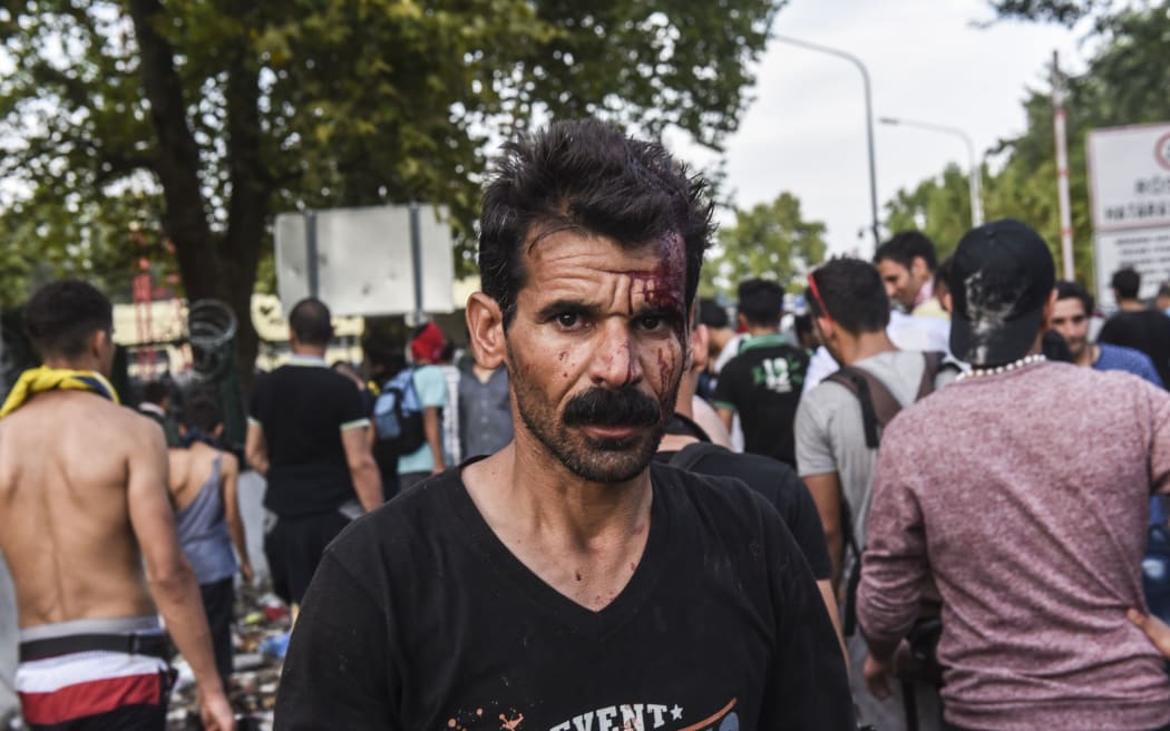 An injured migrant walks away during clashes with Hungarian anti-riot police.