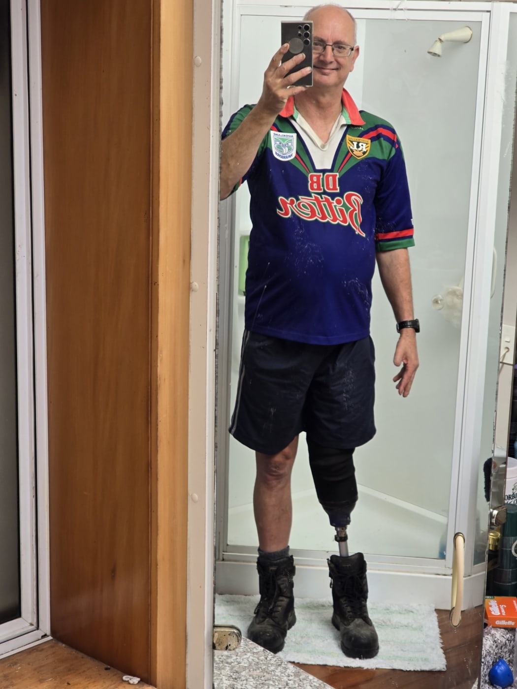 Geoff Lance lost part of his right leg to sepsis.