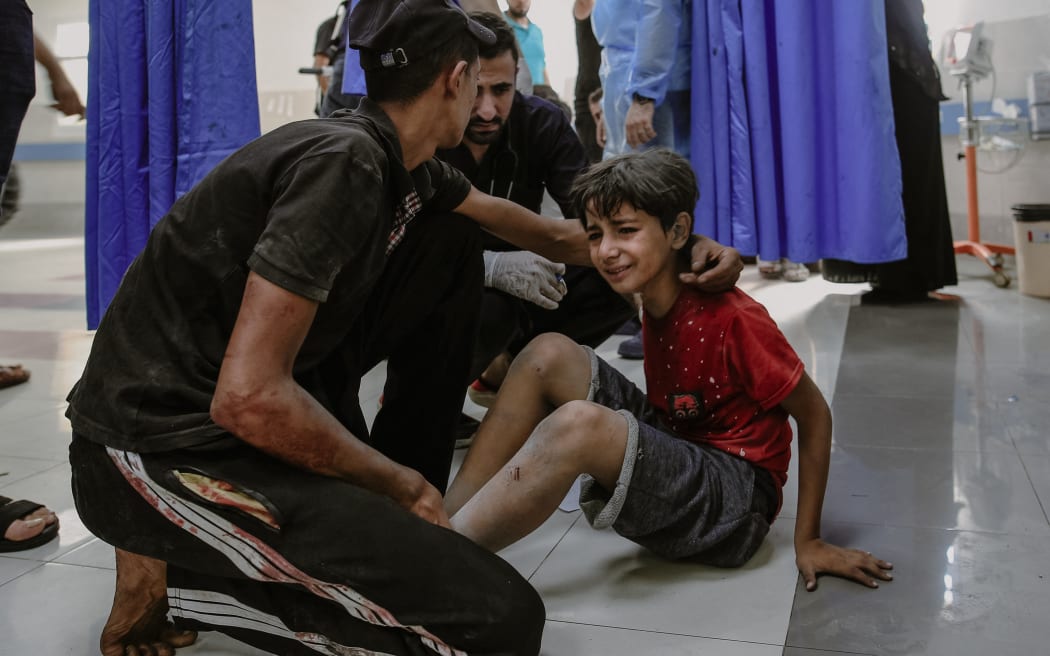 A young injured boy weeps at the overcrowded Al-Shifa Hospital in Gaza City in the aftermath of an Israeli airstrike. Doctors at the hospital are encountering significant difficulties in delivering care due to its current capacity.