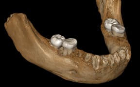 Views of the virtual reconstruction of the Xiahe mandible after digital removal of the adhering carbonate crust. The mandible is so well preserved that it allows for a virtual reconstruction of the two sides of the mandible.