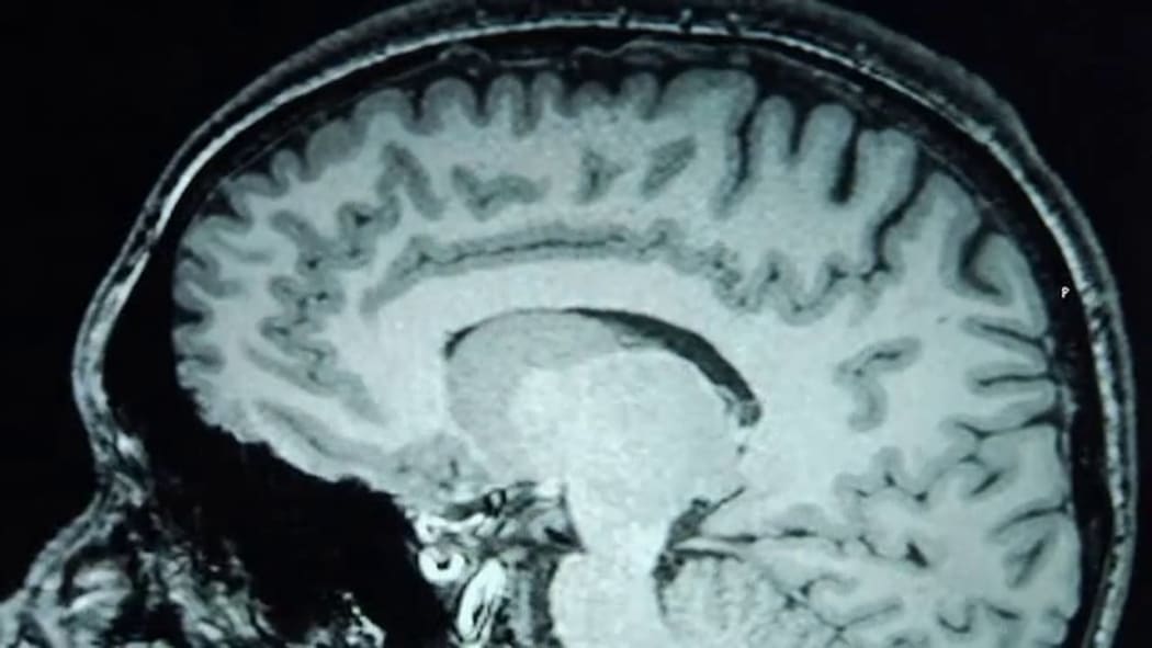 brain scan