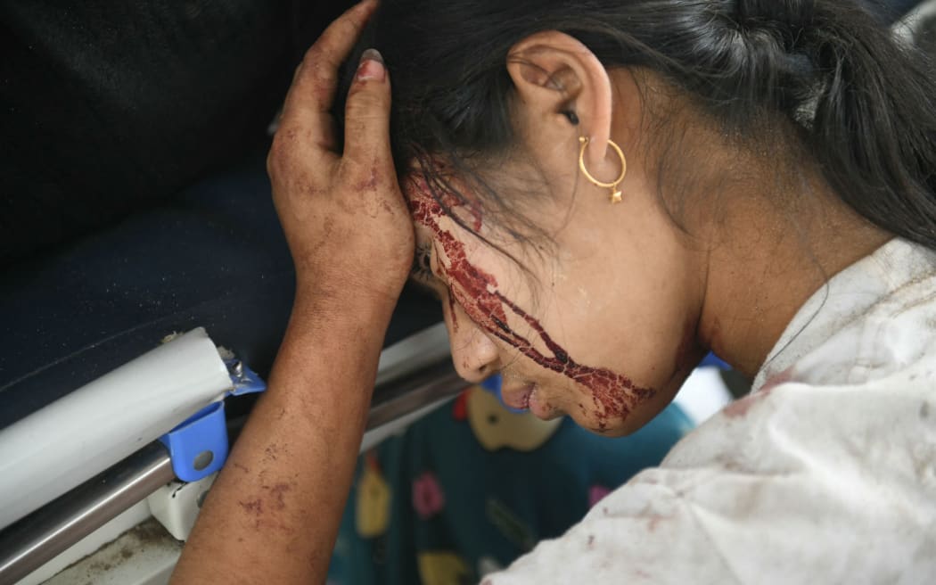 Blood is seen on the face of an earthquake survivors as she rests in a hospital in Naypyidaw on March 28, 2025, after an earthquake in central Myanmar. A powerful earthquake rocked central Myanmar on March 28, buckling roads in capital Naypyidaw, damaging buildings and forcing people to flee into the streets in neighbouring Thailand. (Photo by Sai Aung MAIN / AFP)
