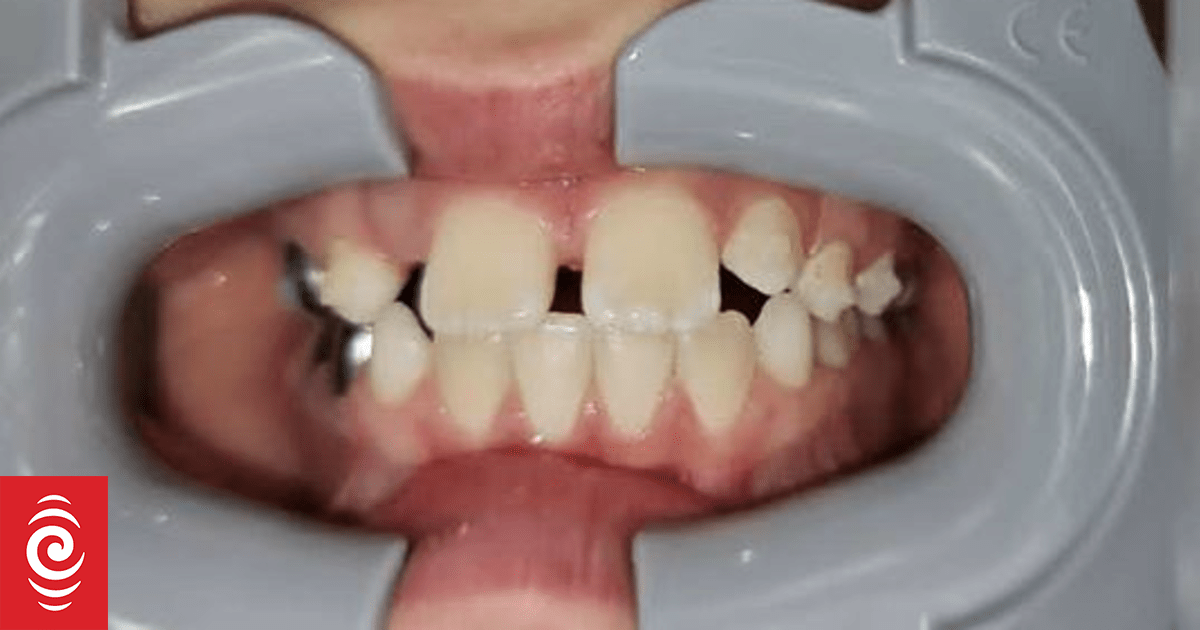 Parents left out-of-pocket as dentist moves to Panama