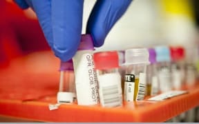 blood testing vacuettes