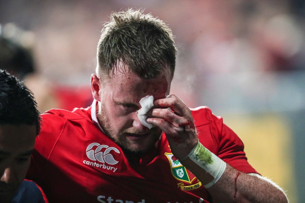 Lions fullback Stuart Hogg leaves the field injured against the Crusaders.