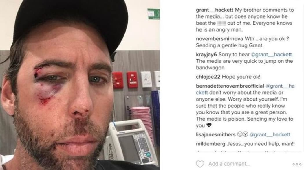 Grant Hackett posted this picture of himself on Instagram.