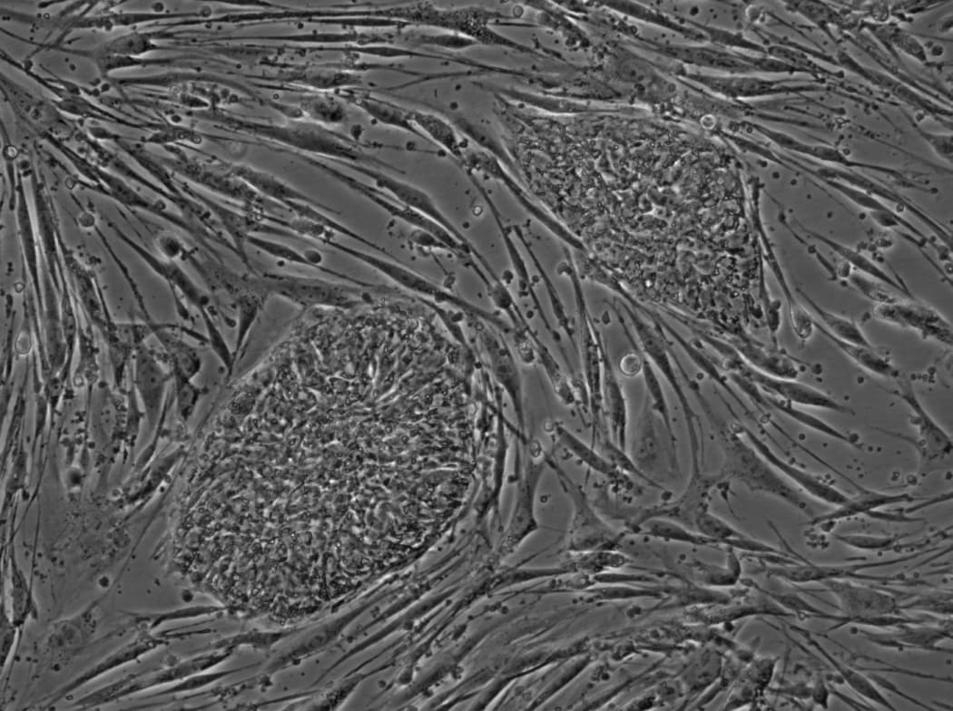 Human stem cells