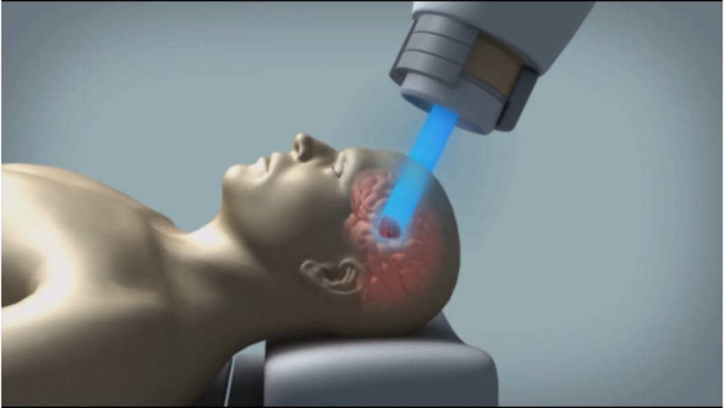 Proton Beam Therapy