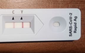 The day 0 rapid antigen test (RAT) that alerted Terry Taylor, president of the New Zealand Institute of Medical Laboratory Science (NZIMLS), that he had contracted Covid-19.