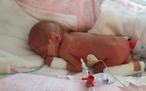 Frankie, who was born at 24 weeks and 3 days, weighing 650 grammes. She was part of Barbara’s study. Frankie is now thriving. The photo was supplied by Frankie’s family.