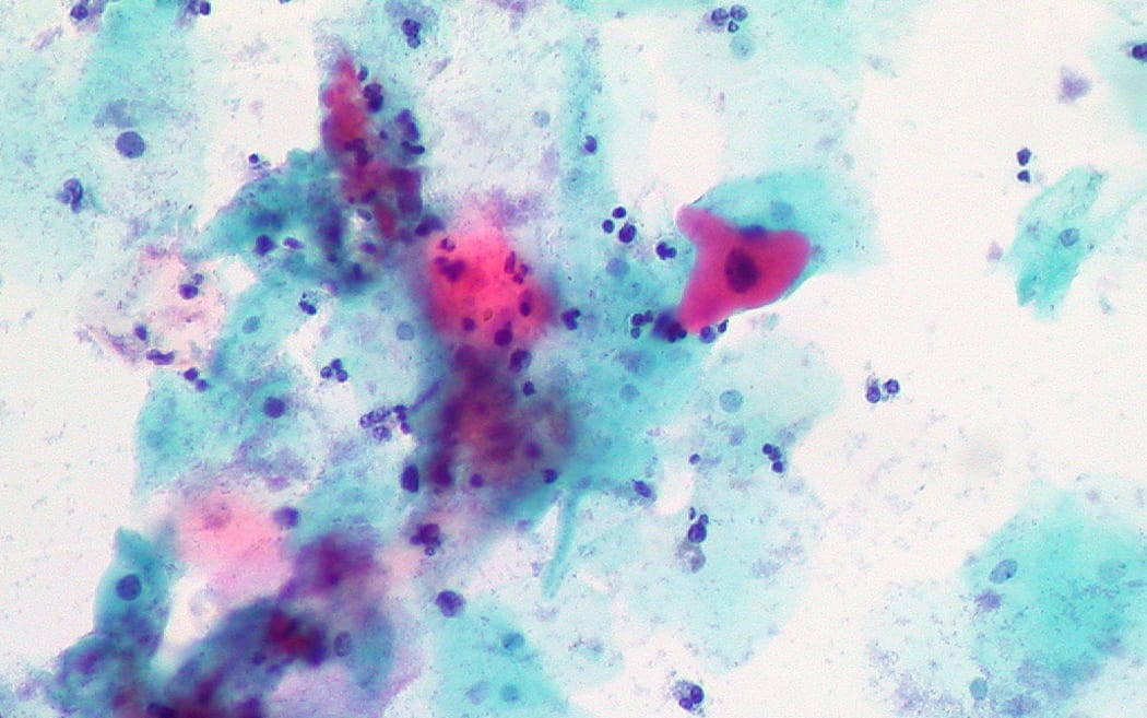Cells from a smear test.