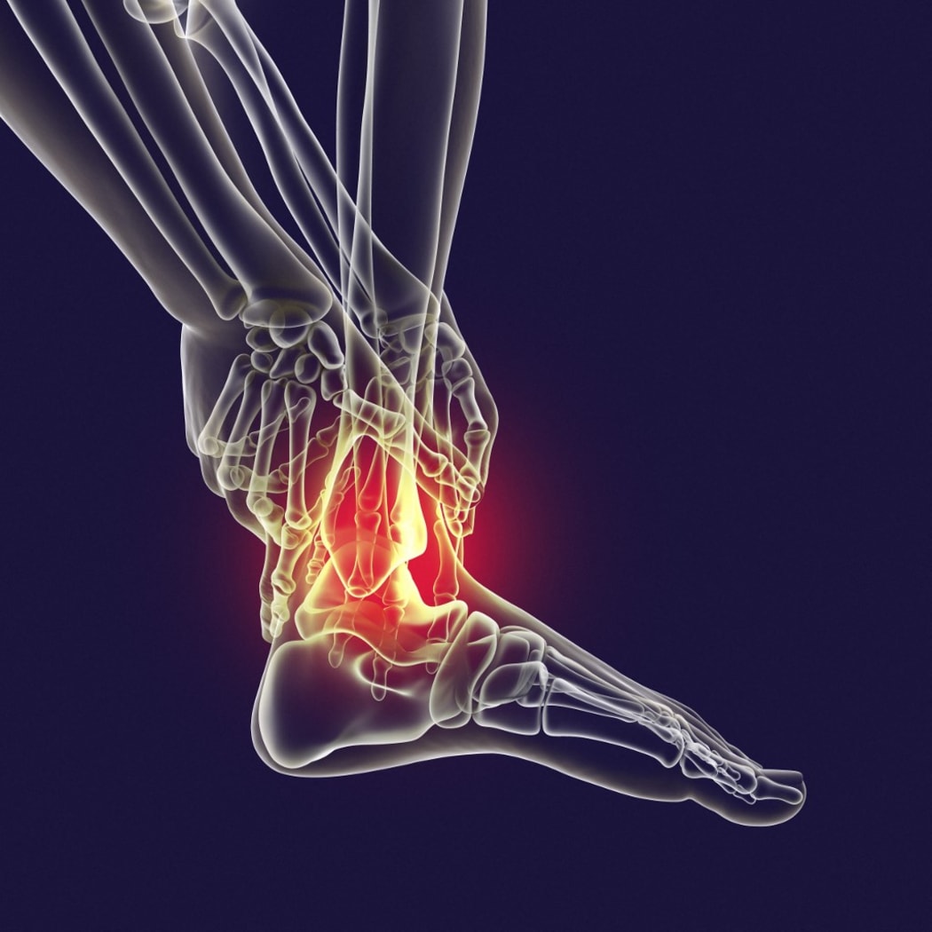 Man with foot pain and highlighted skeleton, computer illustration. (Photo by KATERYNA KON/SCIENCE PHOTO LIBRA / KKO / Science Photo Library via AFP)