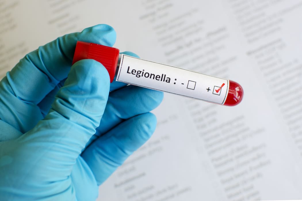 Legionnaires' disease study prompts call for mandatory water tests