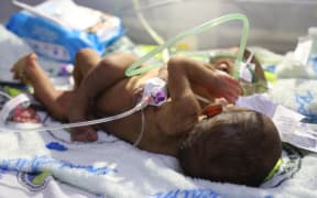 Dr Kone Sobi said it's a precarious condition for both as they depend on each other.