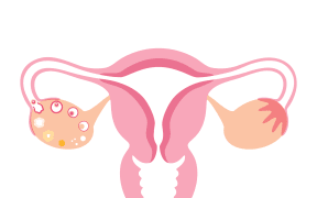 Female reproductive organs, illustration. (Photo by PIKOVIT / SCIENCE PHOTO LIBRARY / TPA / Science Photo Library via AFP)