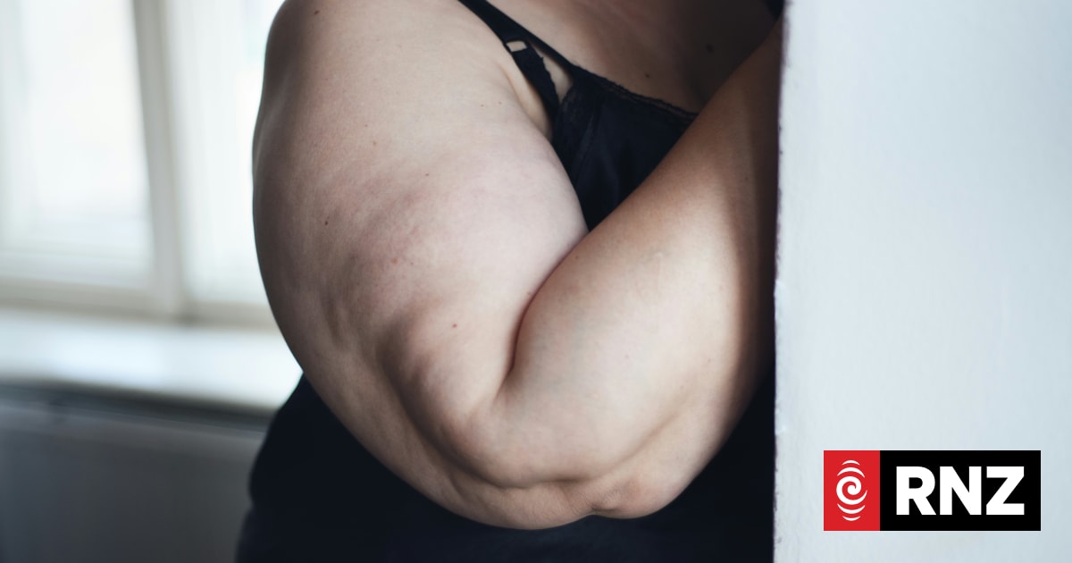 Research suggests eating disorders linked to genetics, not primarily psychological