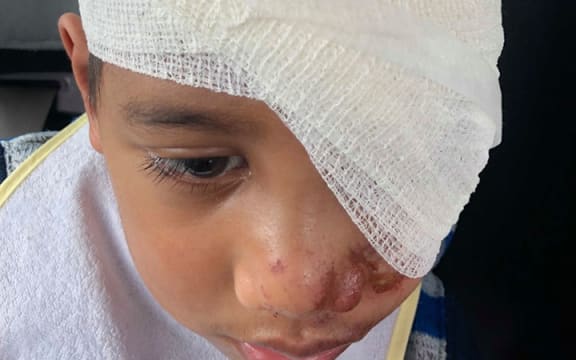 Masua Tusa's mum Mully says her son's injuries looked more like burns.