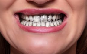 Close-up Of Woman Cleaning Her Teeth With Charcoal Tooth Paste