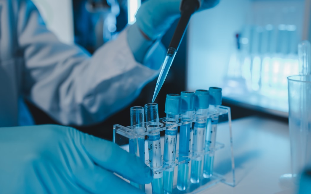 Explainer: What is going on with this death at a Russian lab? | RNZ