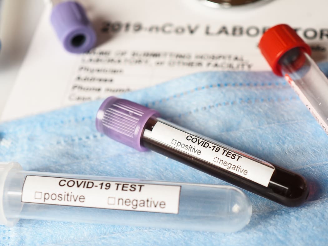 Coronavirus COVID-2019 test concept with blood test tubes, test form and other medical objects