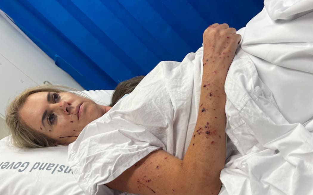 New Zealand survivors of a helicopter crash in Australia's Gold Coast continue their recovery in hospital. The couples are Edward and Marle Swart, and Riaan and Elmarie Steenberg.