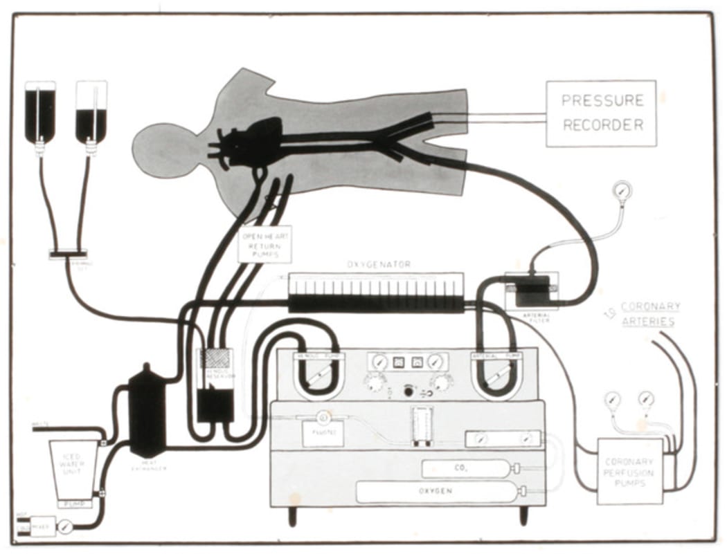 The heart lung bypass machine