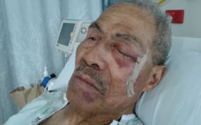 Lolesio Pupu after his treatment