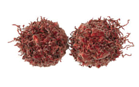 Prostate cancer cells (illustration)