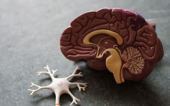Plastic model of a human brain