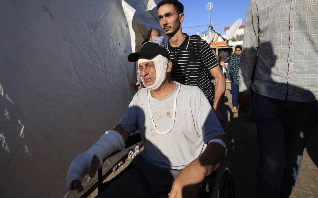 A Palestinian man wounded in Israeli bombardment reacts as he is wheeled outside Al-Aqsa hospital in Deir al-Balah in the centre of the Gaza Strip, on November 17, 2023, amid the ongoing battles between Israel and the Palestinian group Hamas. (Photo by Mahmud HAMS / AFP)